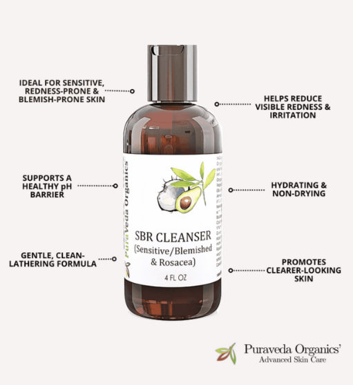 Best Cleanser for Rosacea: How to Choose a Gentle Cleanser for Healthier Skin