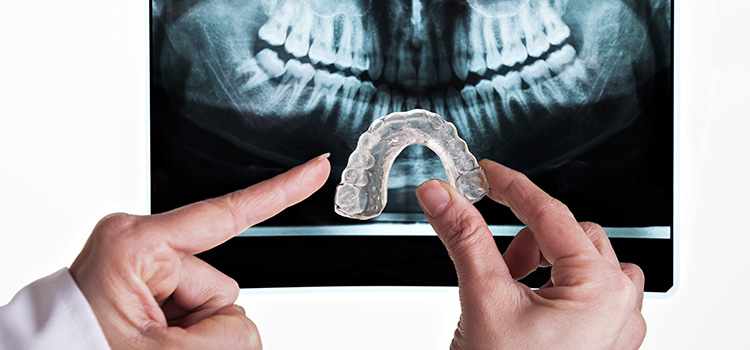 How Dental Implants Work: A Complete Guide