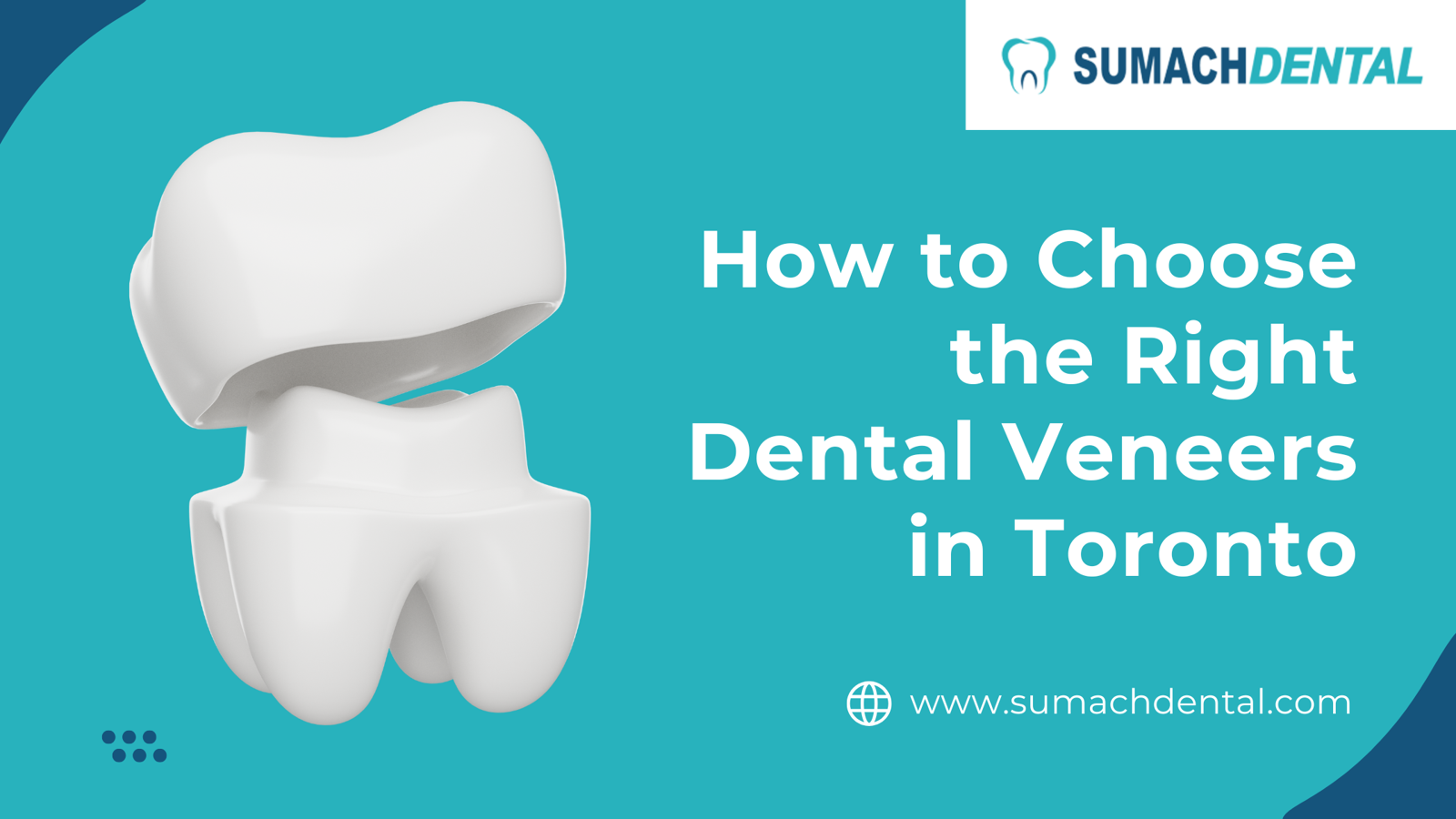 How to Choose the Right Dental Veneers in Toronto