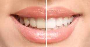 St Augustine Dentistry