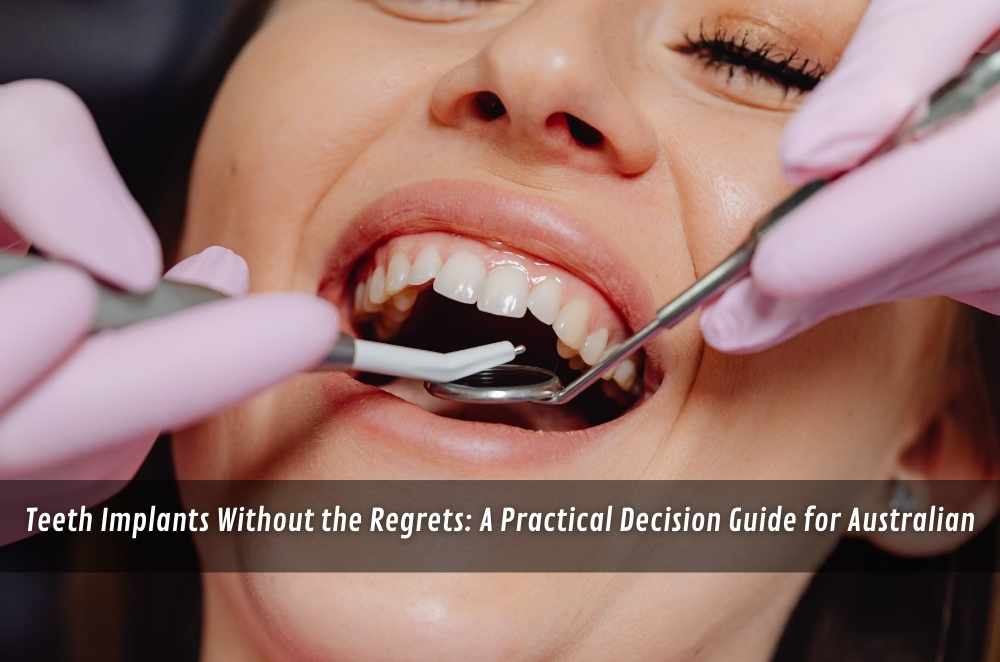 Teeth Implants Without the Regrets: A Practical Decision Guide for Australians