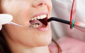 Understand When To Opt For Crown And Bridges Treatment?