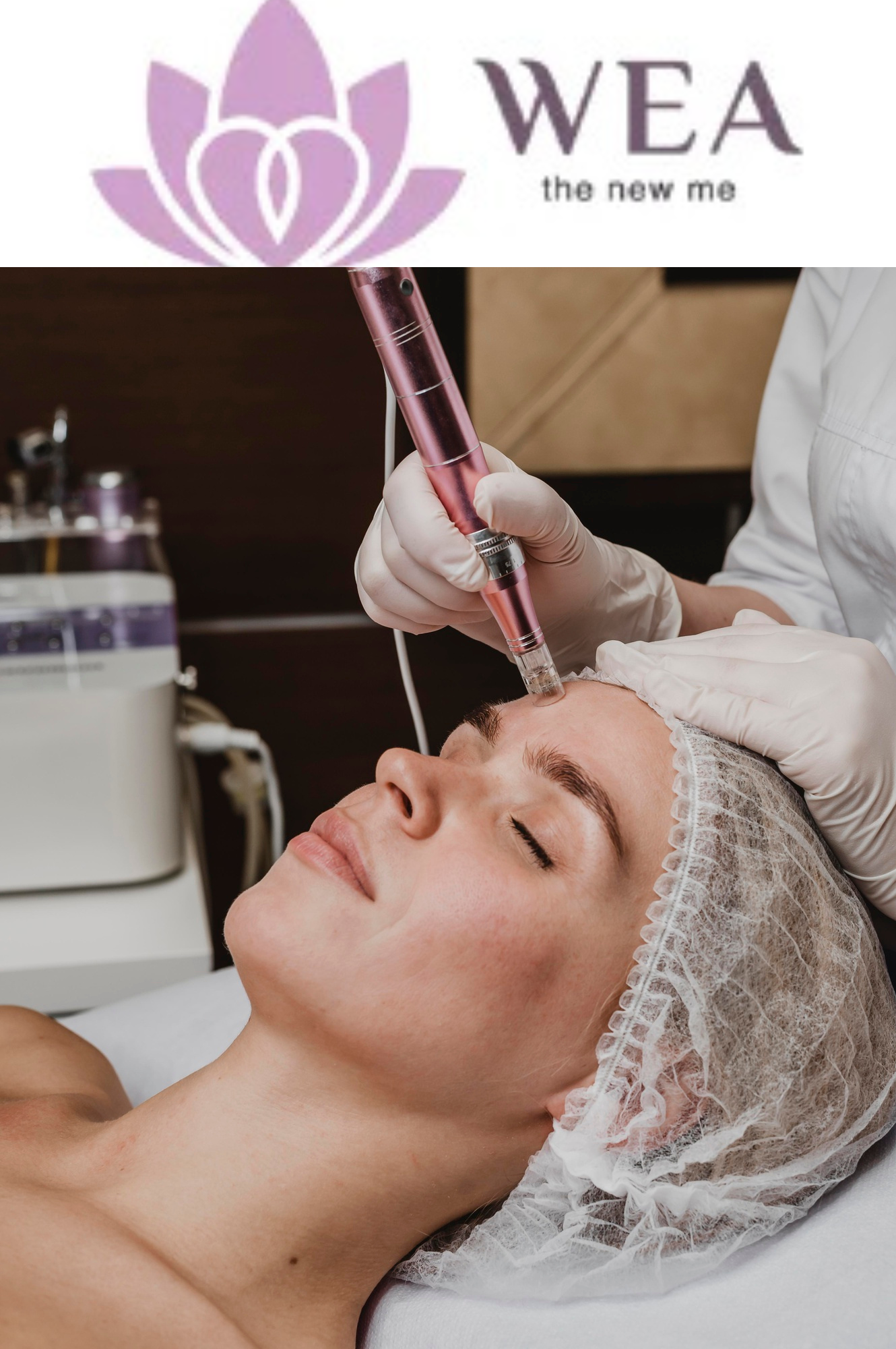 Best Skin Care Clinics in Chennai: A Comprehensive Guide for Radiant Skin