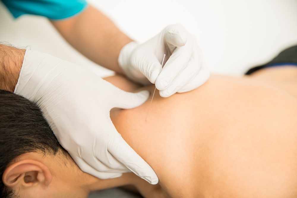 Acupuncture For Muscle Pain: Benefits, Treatment & Relief