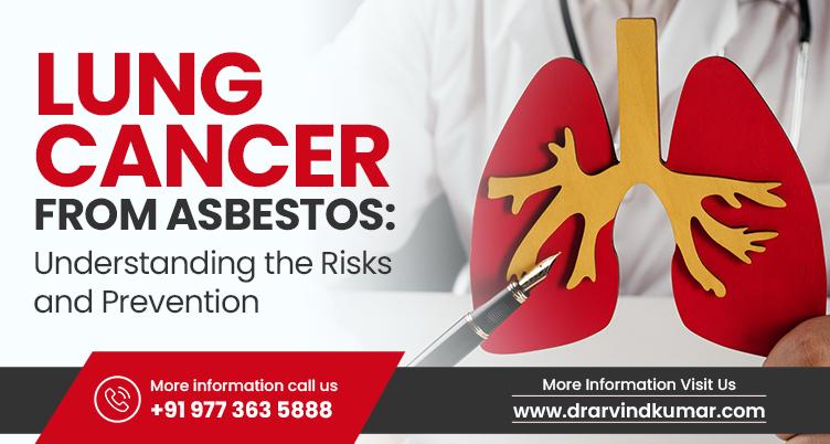 Lung Cancer from Asbestos