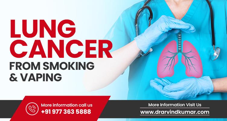 Lung Cancer From Smoking & Vaping