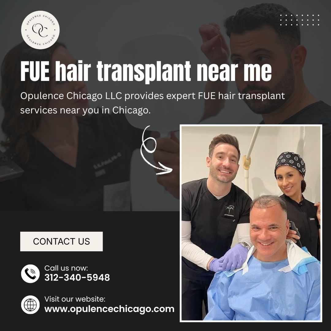 Find Expert FUE Hair Transplant Near Me – Opulence Chicago LLC
