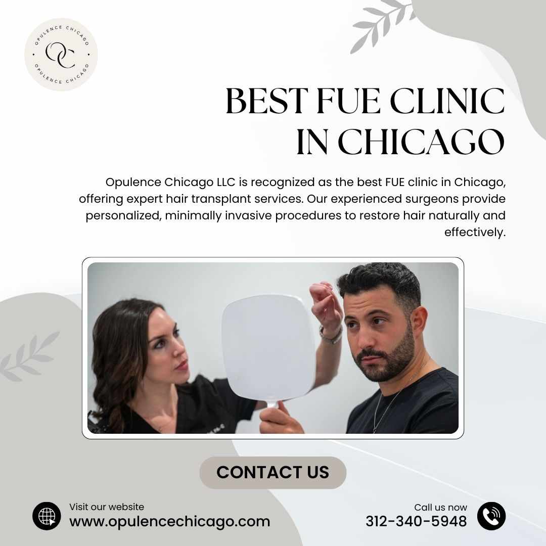 Expert Hair Transplant Services in Chicago – Opulence Chicago LLC