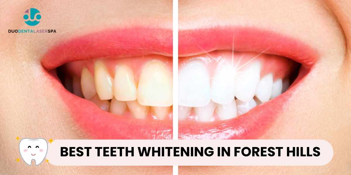 Best Teeth Whitening In Forest Hills