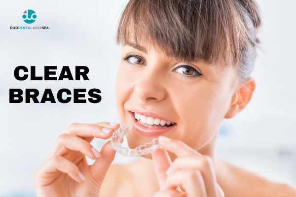 Clear Braces at Duo Dental & Laser Spa