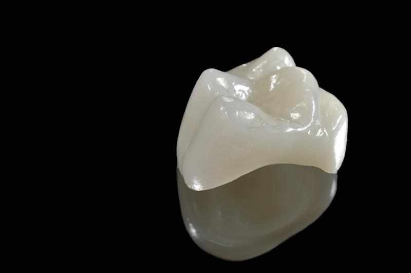 Cerec ® Same day Crowns