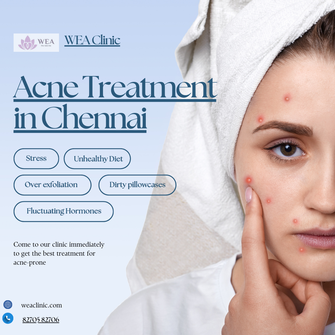 Achieve Clear Skin with Expert Acne Treatment in Chennai at WEA Clinic