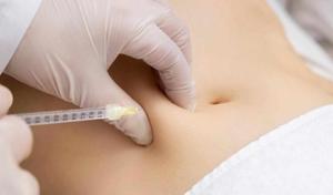 The Comfort Factor: Why Lipolysis Numbing Cream is a Game-Changer