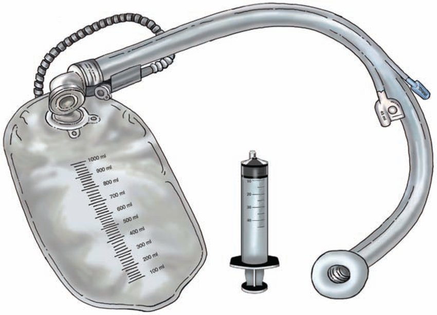 Bowel Management System Market Size, Trends, and Growth Forecast 2025-2032