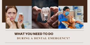 What You Need To Do During A Dental Emergency?