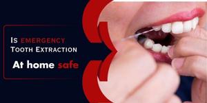 Is emergency Tooth Extraction at Home safe