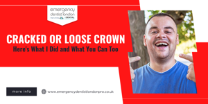 Cracked or Loose Crown? Here's What I Did and What You Can Too