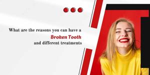 What are the reasons you can have a broken tooth and different treatments