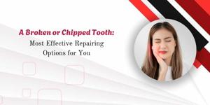 A Broken or Chipped Tooth: Most Effective Repairing Options for You