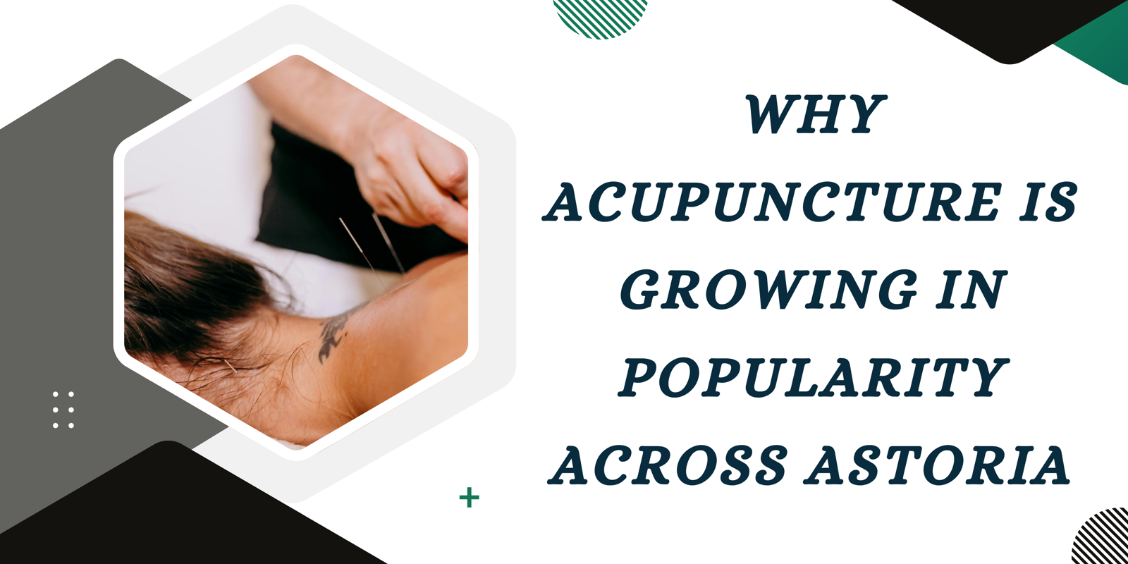 Why Acupuncture is Growing in Popularity Across Astoria