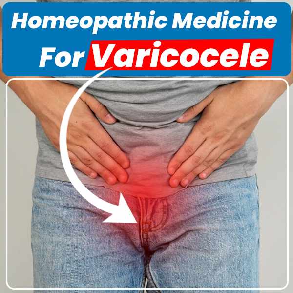 Varicocele Treatment Without Surgery: Natural Homeopathic Remedies