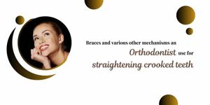 Braces and various other mechanisms an orthodontist use for straightening crooked teeth
