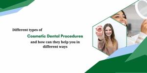 Different types of cosmetic dental procedures and how can they help you in different ways