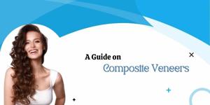 A Guide on Composite Veneers