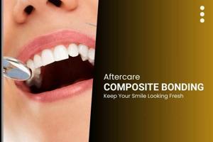 Composite Bonding Aftercare: Keep Your Smile Looking Fresh