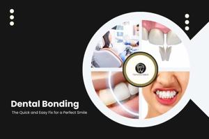 Dental Bonding: The Quick and Easy Fix for a Perfect Smile