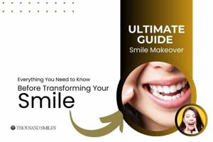 The Ultimate Guide to a Smile Makeover: Everything You Need to Know Before Transforming Your Smile