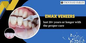 Emax veneers last 20+ years or longer with the proper care