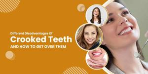 Different Disadvantages Of Crooked Teeth And How To Get Over Them