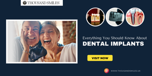 Everything You Should Know About Dental Implants
