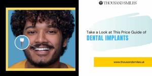 Take a Look at This Price Guide of Dental Implants in 2025