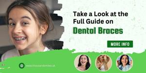 Take a Look at the Full Guide on Dental Braces