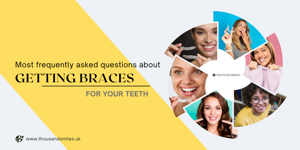 Most frequently asked questions about getting braces for your teeth