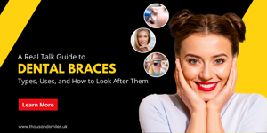 A Real Talk Guide to Dental Braces: Types, Uses, and How to Look After Them