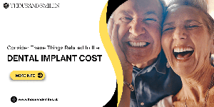 Consider These Things Related to The Dental Implant Cost