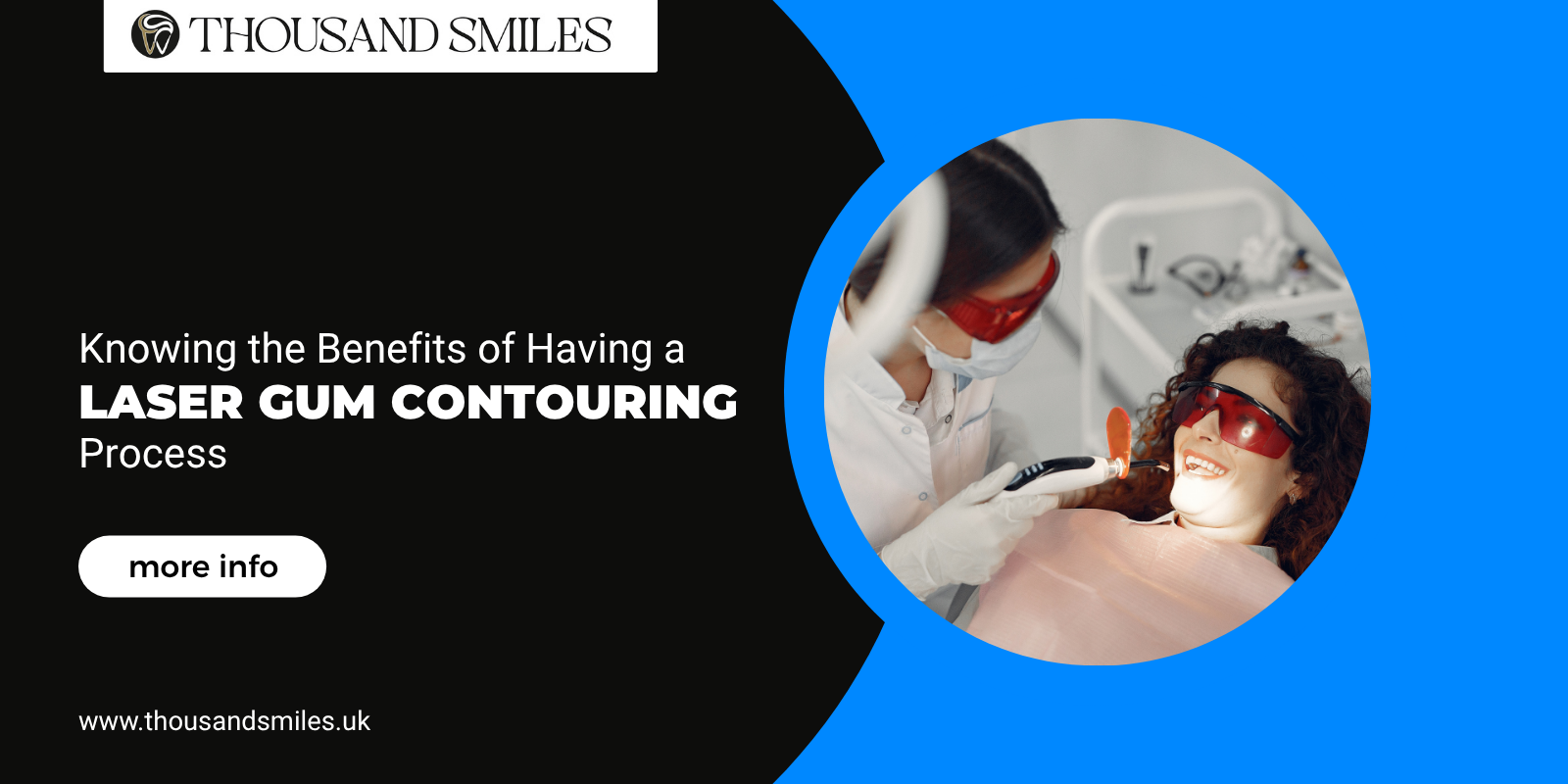 Knowing the Benefits of Having a Laser Gum Contouring Process