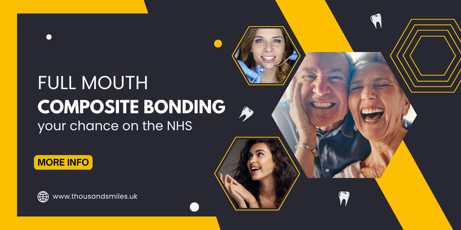 Full mouth composite bonding — your chance on the NHS