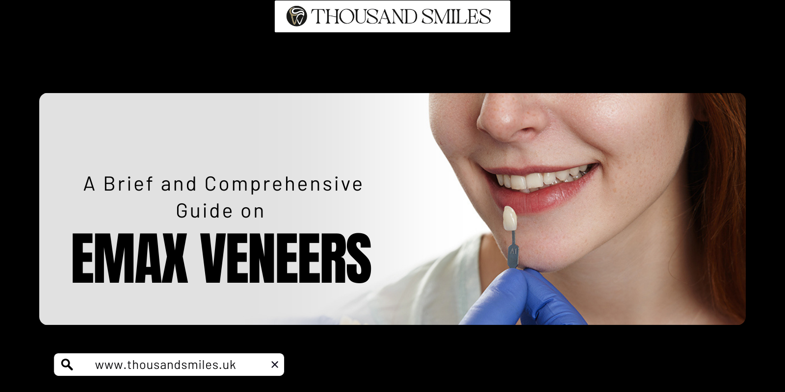 A Brief and Comprehensive Guide on Emax Veneers