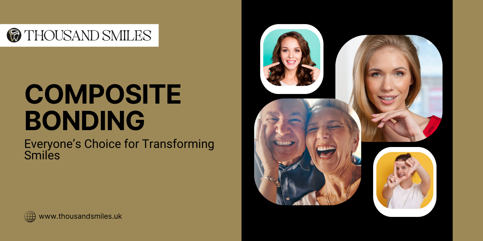 Composite Bonding: Everyone’s Choice for Transforming Smiles