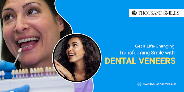 Get a Life-Changing, Transforming Smile with Dental Veneers