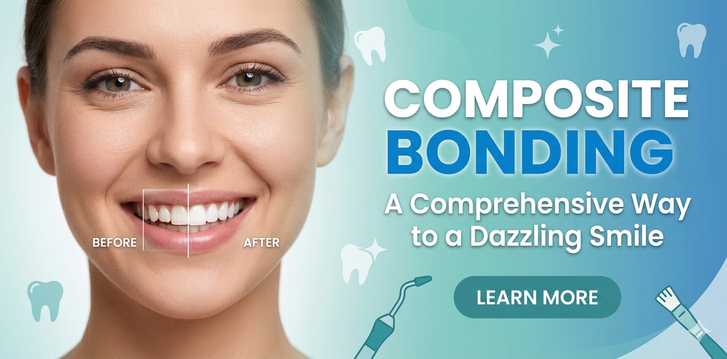 Composite Bonding: A Comprehensive Way to a Dazzling Smile