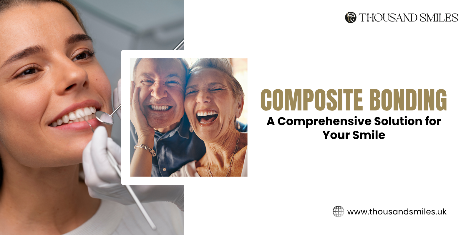 Composite Bonding: A Comprehensive Solution for Your Smile