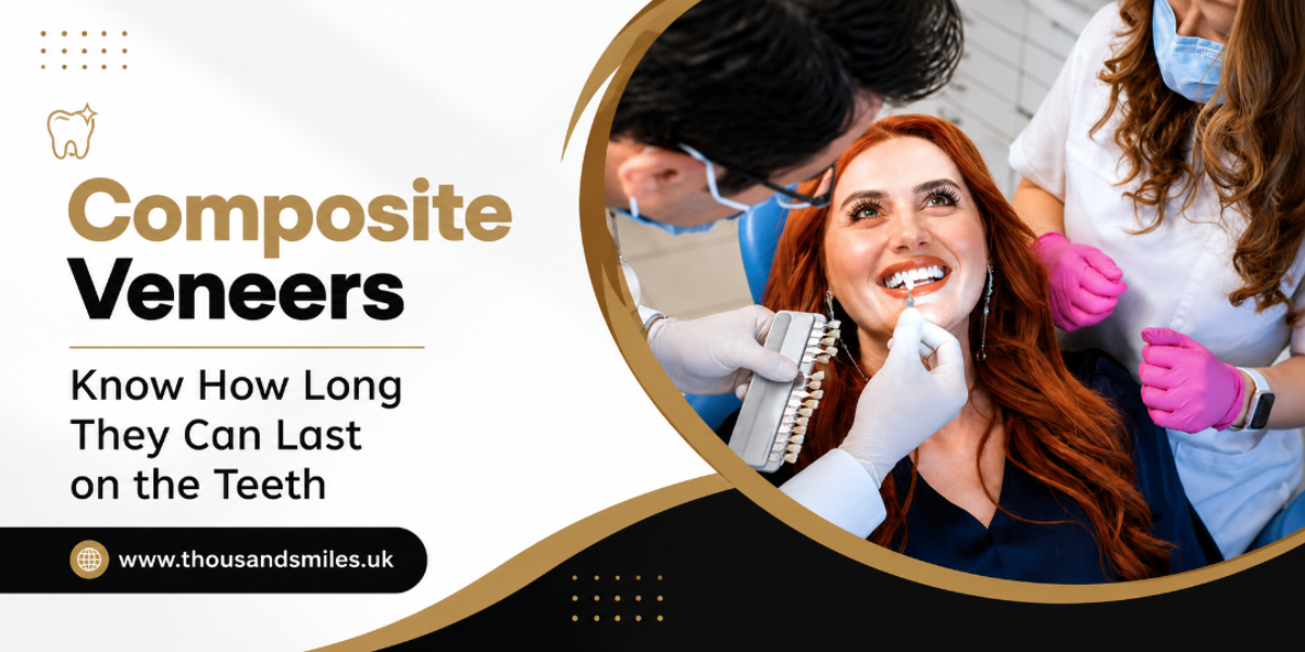 Composite Veneers: Know How Long They Can Last on the Teeth