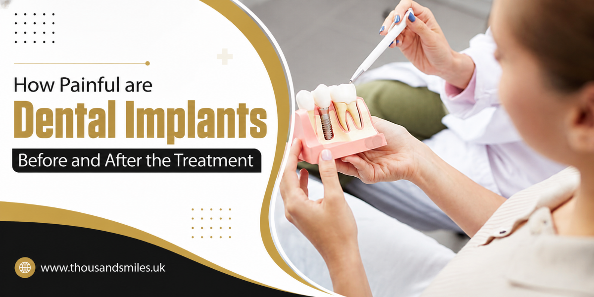 How Painful are Dental Implants Before and After the Treatment