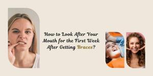 How to Look After Your Mouth for the First Week After Getting Braces?