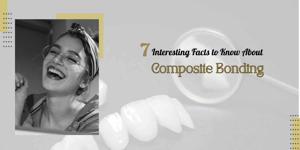 7 Interesting Facts to Know About Composite Bonding
